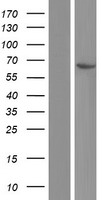 CROT Human Over-expression Lysates NM_001143935