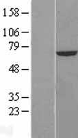 CROT Human Over-expression Lysates NM_021151