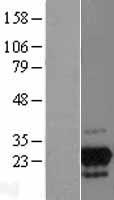 ls054707 gpn2 human over expression lysates nm 018066 wb testing 1