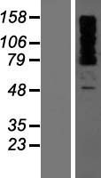 OTUD4 Human Over-expression Lysates NM_001102653