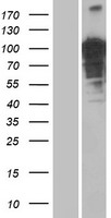 OTUD4 Human Over-expression Lysates NM_199324