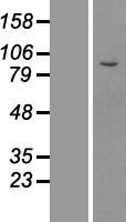 MPP8 (MPHOSPH8) Human Over-expression Lysates NM_017520