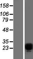 Pet1 (FEV) Human Over-expression Lysates NM_017521