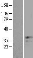 XAF1 Human Over-expression Lysates NM_017523