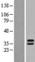 Lymphocyte Antigen 6 Complex (LY6K) Human Over-expression Lysates NM_017527