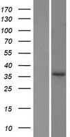 EPDR1 Human Over-expression Lysates NM_017549