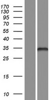 FBLIM1 Human Over-expression Lysates NM_001024216