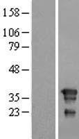 FNDC8 Human Over-expression Lysates NM_017559