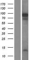 NUTM2F Human Over-expression Lysates NM_017561