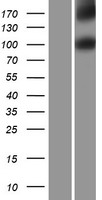 IL17RD Human Over-expression Lysates NM_017563