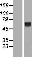 KLHDC4 Human Over-expression Lysates NM_017566