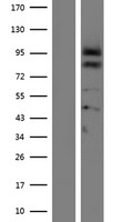 Proprotein convertase PC4 (PCSK4) Human Over-expression Lysates NM_017573