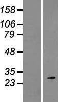 ROPN1 Human Over-expression Lysates NM_017578