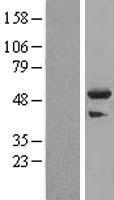 TRIM44 Human Over-expression Lysates NM_017583
