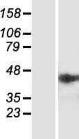 NSMCE4A Human Over-expression Lysates NM_017615