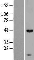 KCTD9 Human Over-expression Lysates NM_017634