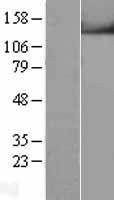 TRPM4 Human Over-expression Lysates NM_017636