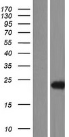 MED18 Human Over-expression Lysates NM_001127350