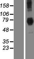 Dymeclin (DYM) Human Over-expression Lysates NM_017653
