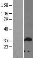 GIPC (GIPC2) Human Over-expression Lysates NM_017655
