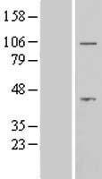 Aftiphilin (AFTPH) Human Over-expression Lysates NM_001002243