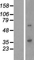 QPCTL Human Over-expression Lysates NM_017659