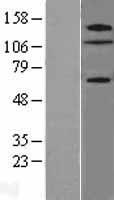 ZNF280D Human Over-expression Lysates NM_017661