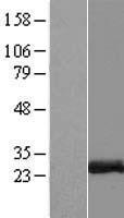 ZCCHC10 Human Over-expression Lysates NM_017665