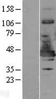 NDE1 Human Over-expression Lysates NM_017668
