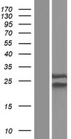NUP62CL Human Over-expression Lysates NM_017681