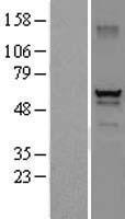 DEF8 Human Over-expression Lysates NM_207514