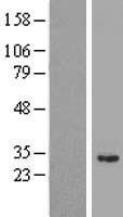 ANKRD49 Human Over-expression Lysates NM_017704