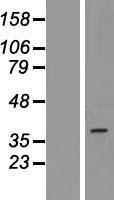PAQR5 Human Over-expression Lysates NM_017705