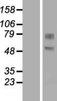 GDPD2 Human Over-expression Lysates NM_017711
