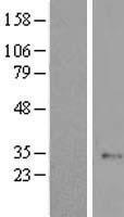 ELP6 Human Over-expression Lysates NM_001031703