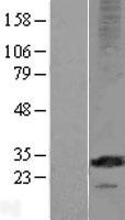 MS4A12 Human Over-expression Lysates NM_017716