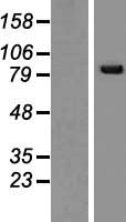 SNRK Human Over-expression Lysates NM_017719