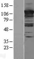 ls054862 cc2d1a human over expression lysates nm 017721 wb testing 1