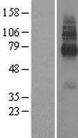 TMEM104 Human Over-expression Lysates NM_017728