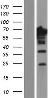 EPS8L1 Human Over-expression Lysates NM_017729