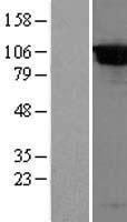 DPP8 Human Over-expression Lysates NM_130434