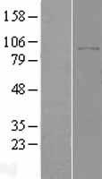 DPP8 Human Over-expression Lysates NM_197961