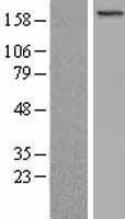 BCOR Human Over-expression Lysates NM_001123383