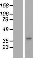 plasticity related gene 3 (PLPPR1) Human Over-expression Lysates NM_017753