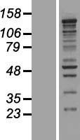 CASZ1 Human Over-expression Lysates NM_017766