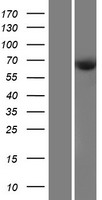 CDKAL1 Human Over-expression Lysates NM_017774