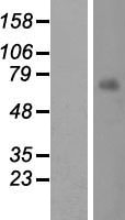 MKS1 Human Over-expression Lysates NM_017777