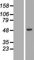CYP2W1 Human Over-expression Lysates NM_017781