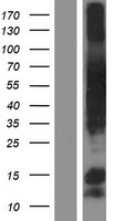 Spindly (SPDL1) Human Over-expression Lysates NM_017785