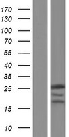 ls054913 rpp25 human over expression lysates nm 017793 wb testing 1
